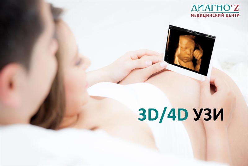 3D/4D УЗИ при беременности